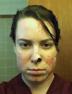 Dr. Woods was also covered in burn scars, missing part of her nose, and very cranky. And I'm mostly posting this picture because I am pleased with the makeup, even though it has very little to do with the article.